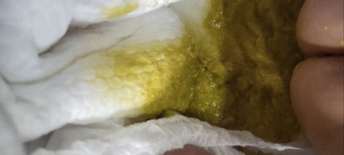 susu formula newborn