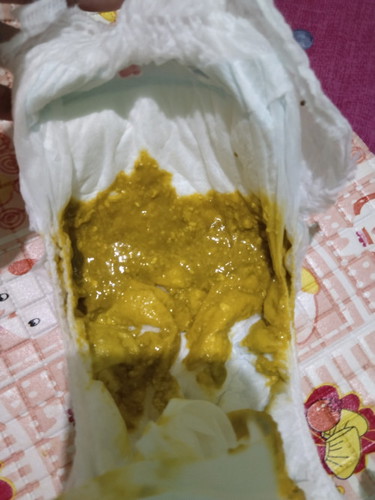 Bun mau nanya bab anak ku kek gini usia 4 bln