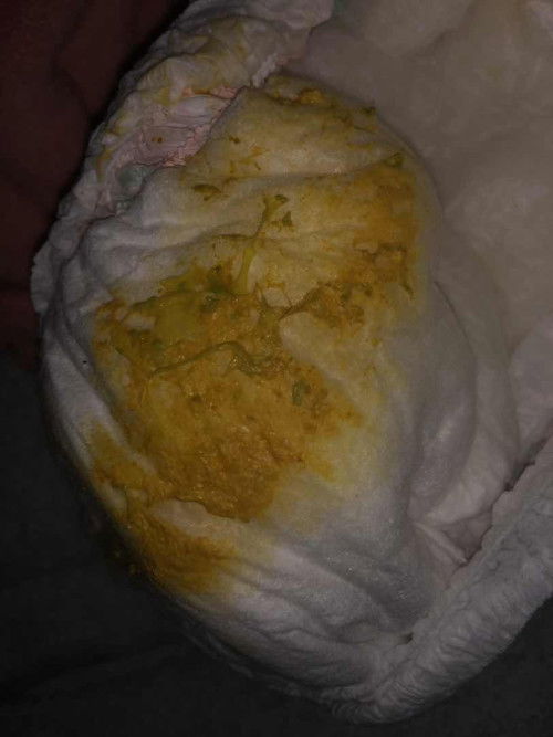 น้องอึแบบนี้ปกติไหมคะแม่ๆ