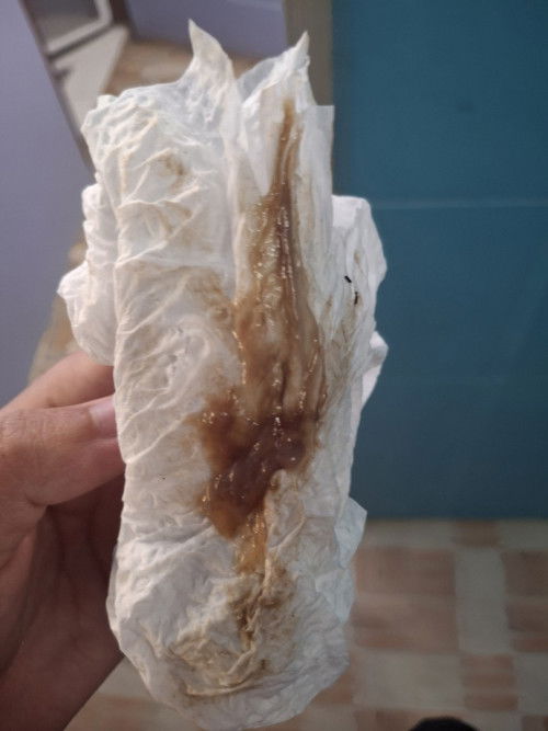 มูกเลือดออกติดต่อกันถึง3วัน เเต่ไม่มีอาการปวดท้องไปหาหมอเเล้วปากมดลูกเปิด2เซน