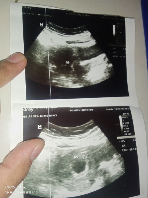 ijin bertanya bunda"