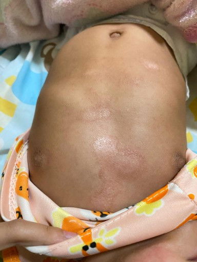 แบบนี้มันคืออะไรคะแม่ๆ ใช่เชื้อราไหมคะ  มียาแนะนำไหมคะ