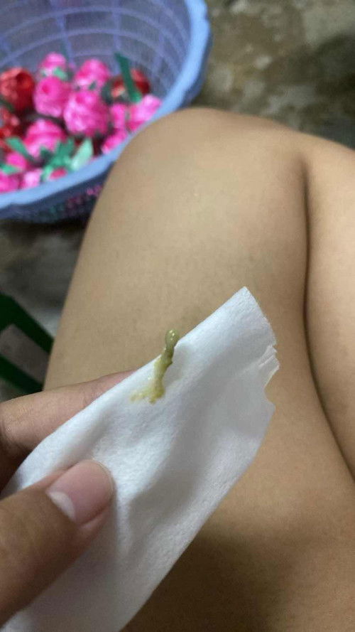 น้ำมูกลูกสีนี้เป็นอะไรมั้ย