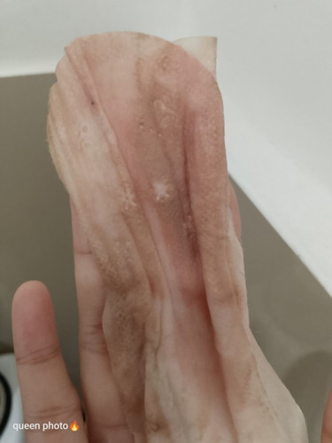 NORMAL LANG BA TO SA FIRTS TRIMENTER NA MY DUGO PERO DINAMAN GAANO KADAMI 1MONTH PREGGY PO AKO