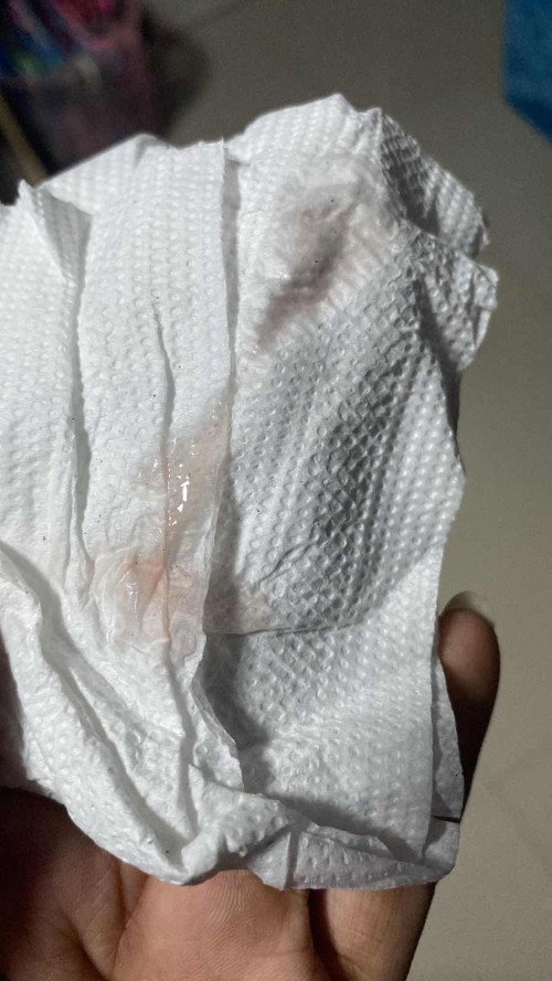 38+6 สัปดาห์