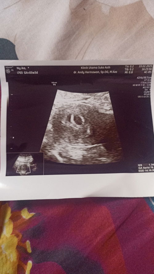 Bun usia hamil 6w1day