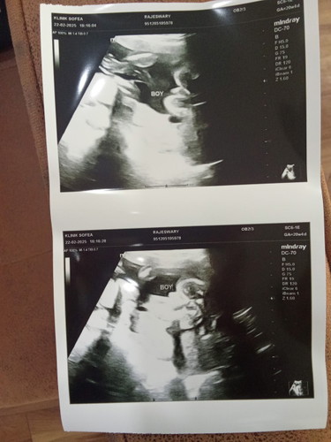 Mummy's confirm ke baby boy? Sy ada 5girl..