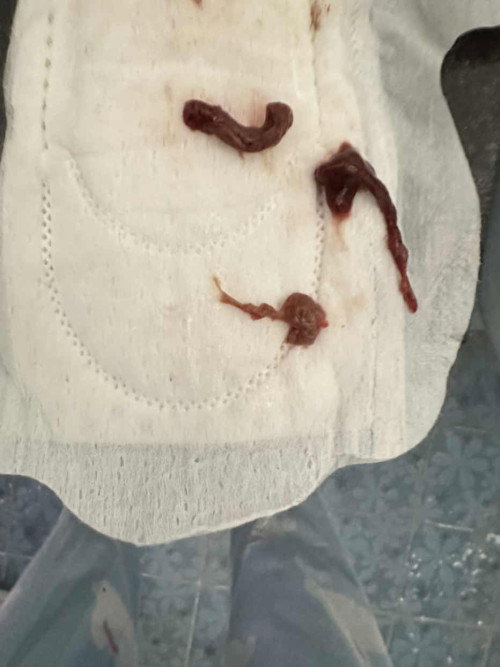 คืออะไรคะ ปกติหรือป่าวคะ