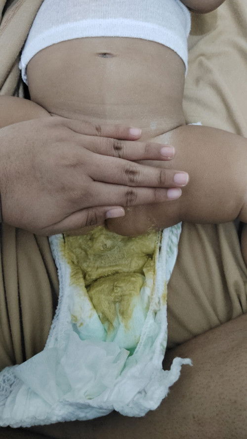 Bund fases ank sya knp begini ya? Apa ini diare bun? Bayi saya umur 6 bulan 20 hari, dan minum sufor