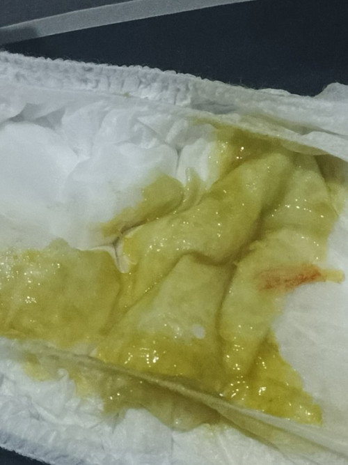 Apakah normal bab bayi 5 bulan 1 minggu seperti ini
