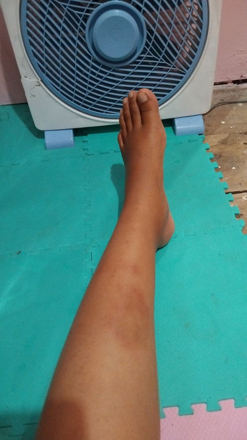 Assalamualaikum  ada yang tau gak ini kenapa soalnya semenjak hamil jadi gini?