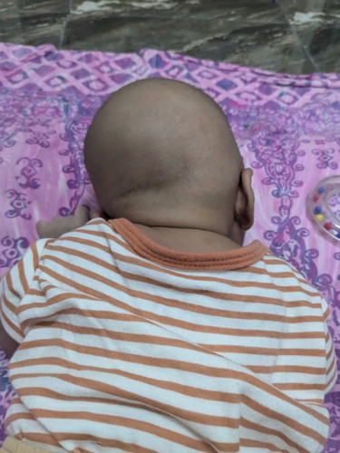 Kepala bayi newborn senget
