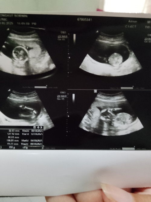 70%ของหมอสามารถคอนเฟิร์มได้ไหมคะ