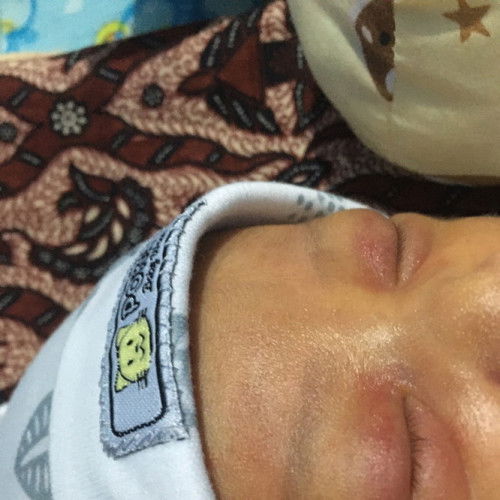 Saran cream buat area mata sensitif newborn
