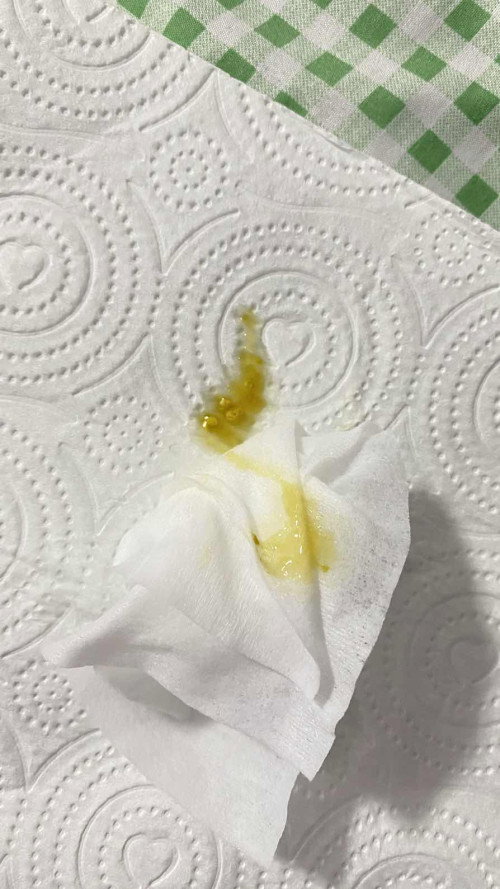 น้องอายุ 1 เดือน 24 วัน กินนมผง