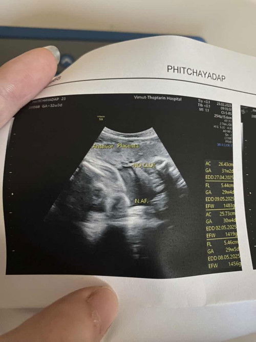 แม่ๆดูให้หน่อยได้ไหมคะดูยังไงก็ดูไม่ออกว่าเพศอะไรหรือตรงนี้คือจุดไหนของน้อง555