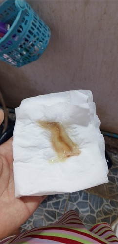 มีแบบนี้ออกมาปกติมัยค่ะ