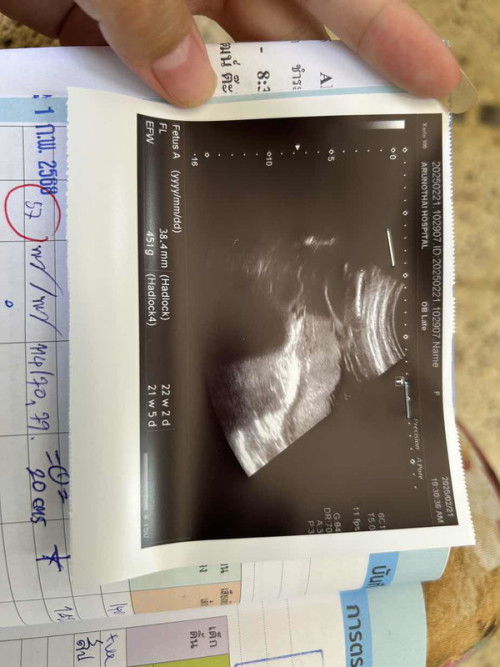 น้องอยู่ตรงไหนคะ แม่ๆช่วยดูหน่อยค่ะ 21+4 วีคค่ะ