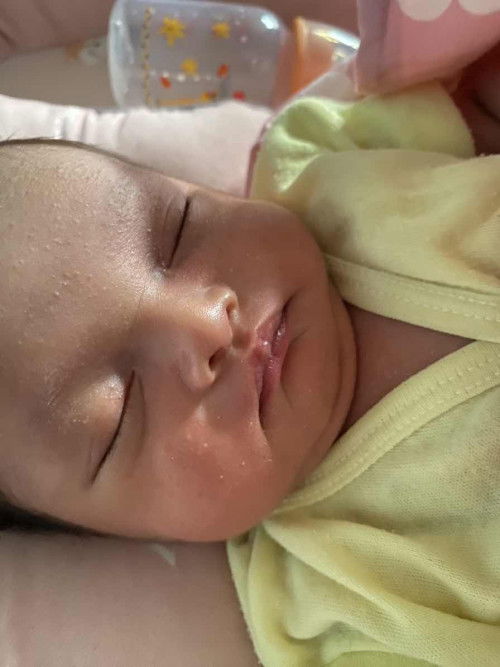 Bintik di wajah bayi