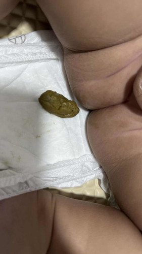 Baby poop 💩