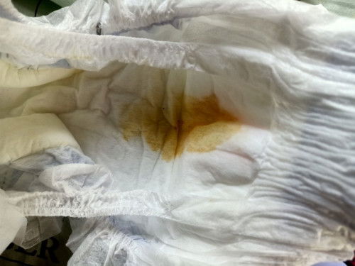 3 weeks old baby, mixed feeding, via ECS