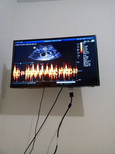 USG 9 minggu