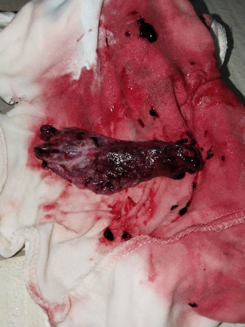 Pasintabi po pasinsya na 2 mo's and 6 days