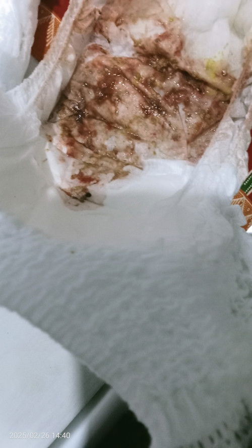 Bab hijau berlendir dan ada darah sedikit