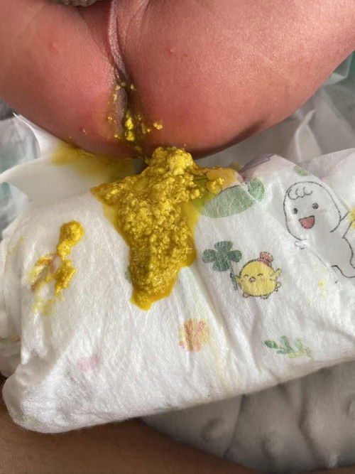 ขอสอบถามค่ะ กังวลมาก