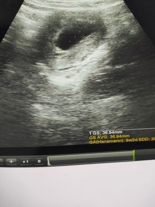 Muncul flek tiba tiba