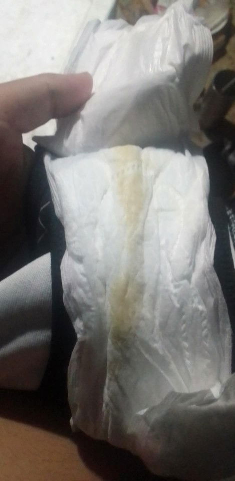 36wตกขาวสีนี้ปกติมั้ยคะ