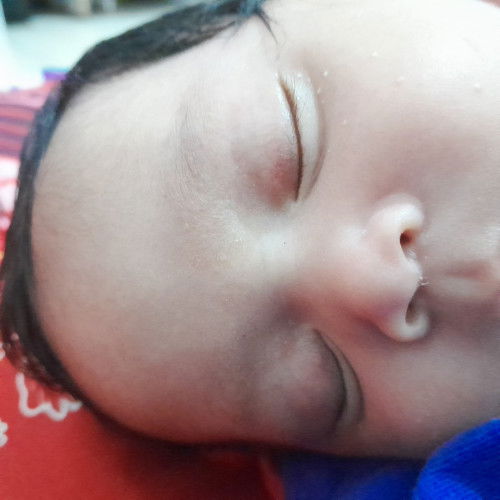 Wajar ga sih bun kalau bayi umur 1 bulan ada kantung mata nya ?