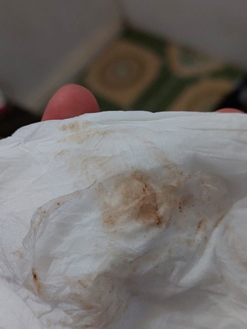 Flek lagi aku, kenapa aku flek terus