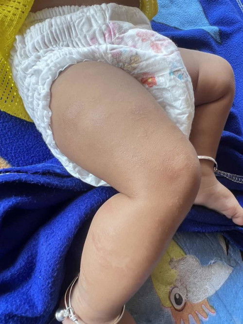 สอบถามเเม่ๆค่ะ