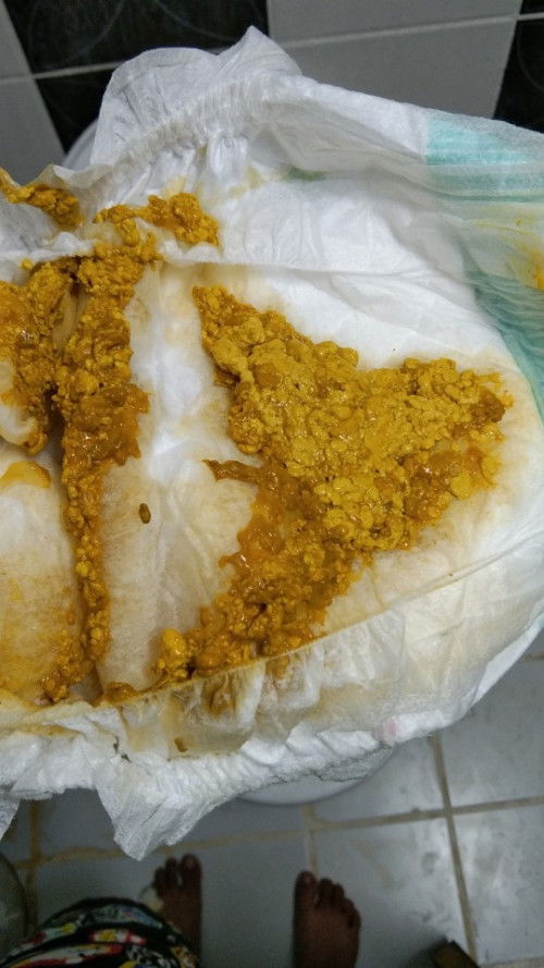 อึแบบนี้ปกติมั้ยคะ