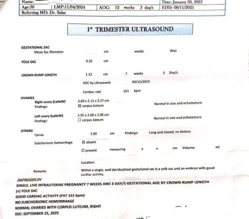 Hirap pag Irregular Meanstration dahil sa PCOS  tapos nawala,  Buntis na pala ako