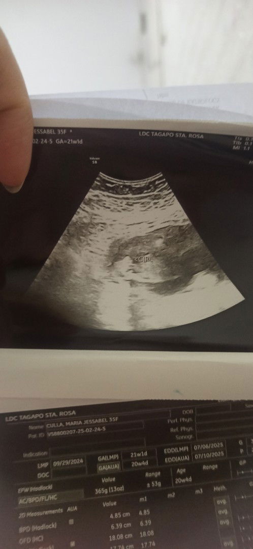 Sa tingin niyo po girl or boy