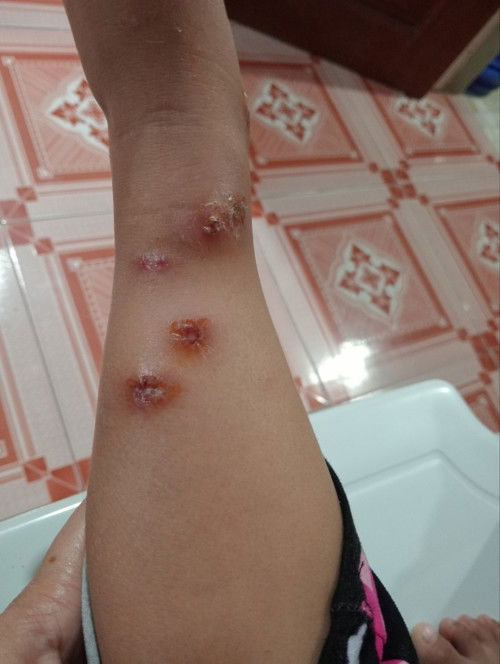 Good evening po mga mommy,ano po pwede e gamot sa sugat ni baby na nanganganak.Salamat