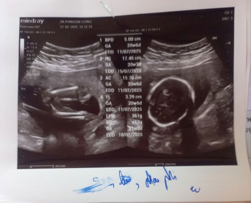 หญิงหรือชาย