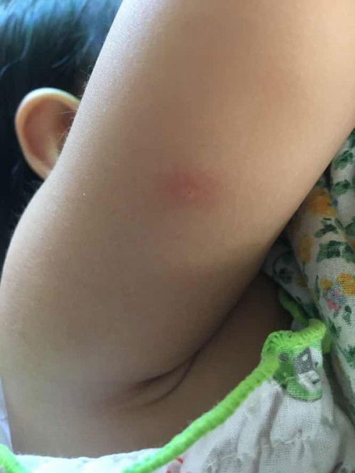 เป็นตุ่มใสๆตรงกลาง