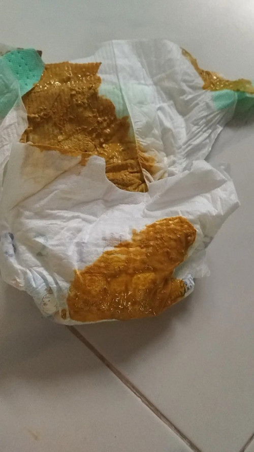 สอบถามเเม่ๆค่ะ