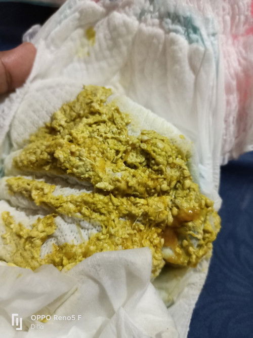 gara gara mpasi dini kah ini?