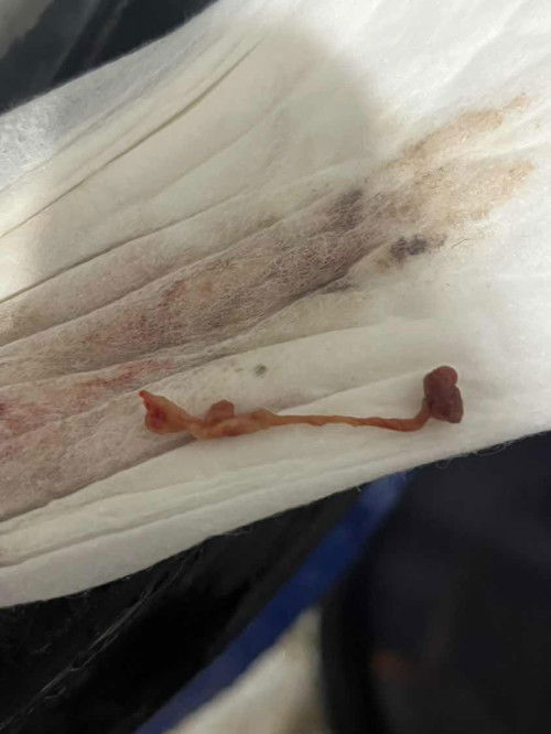 May kasamang laman sa discharge