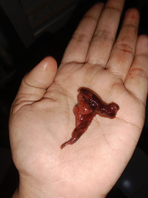 Keluar sesuatu pas kencing