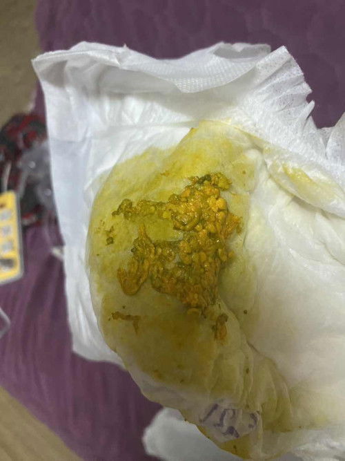 การขับถ่ายของทารก