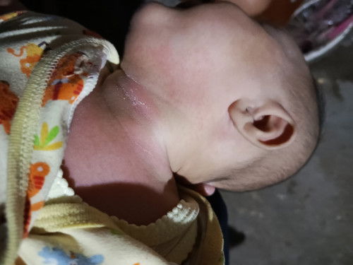 Kak mau tanya obat merah² kyk gtu apa ya kak udh pake salep tp msh sama aja