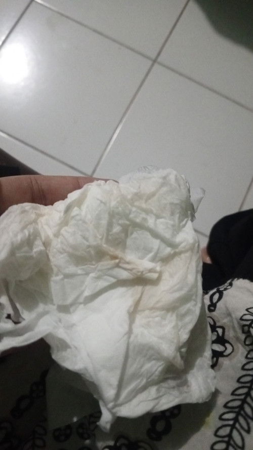 Flek di kehamilan 20 minggu