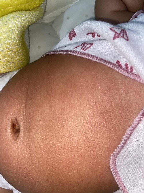 Kulit bayi