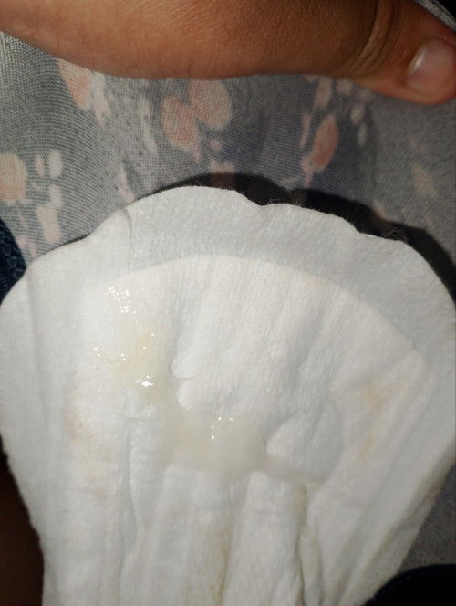 Tanda ke atau keputihan?