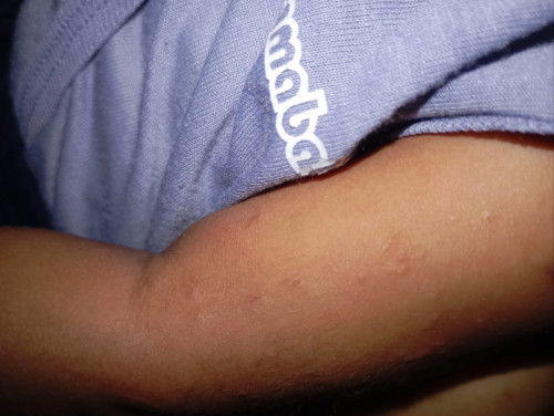 Kira kira ini knp ya Bun? Ada yg pernah bayi nya kaya gini juga?